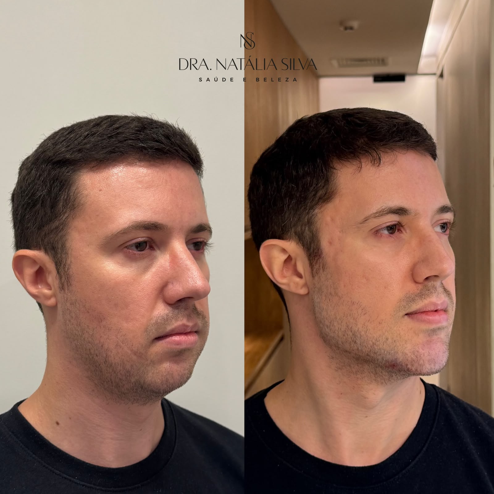 Full Face masculino